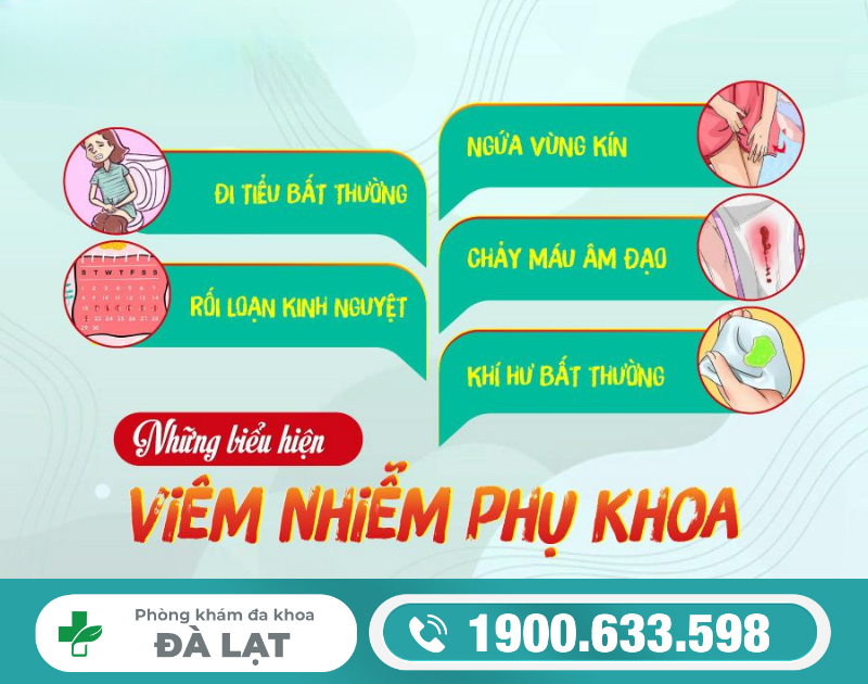 Hình ảnh minh họa